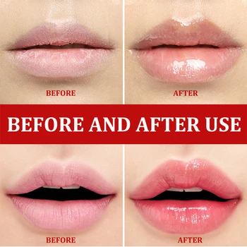 Ustnice Pink Sveže Strela Belilno Kremo Zdravljenje Odstranite Temen Dim Ustnice Ustnice Beljenje zob Bistvo Balzam za Ustnice 5
